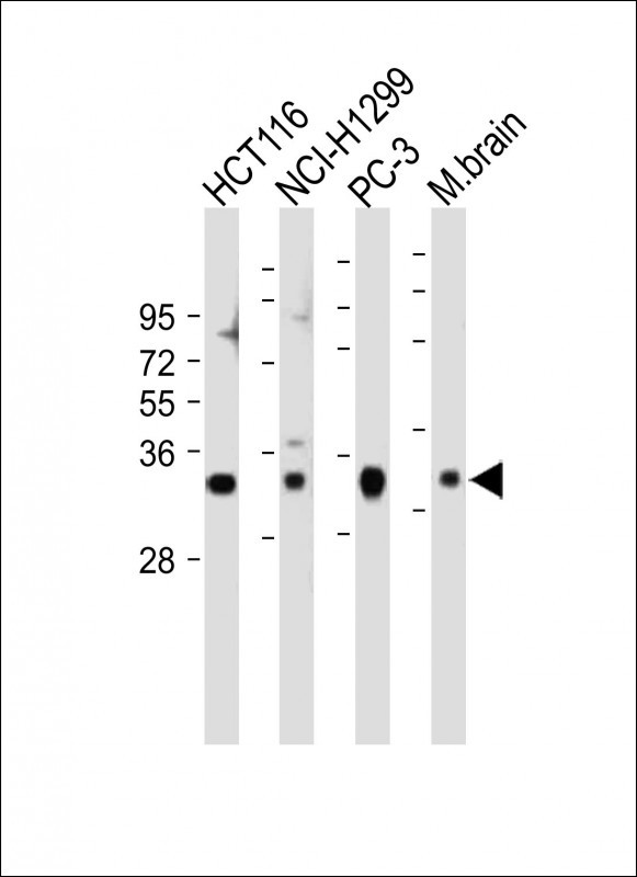 VDAC2 (N-term)