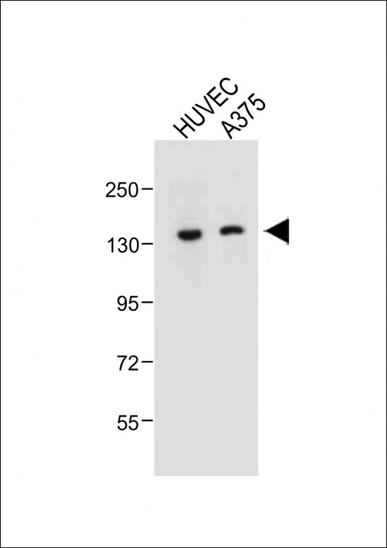 TECPR1