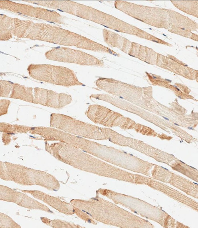METTL4