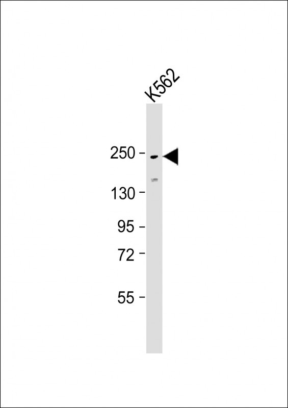 ATG2A