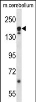 Rabbit Polyclonal Antibody to ATG2A