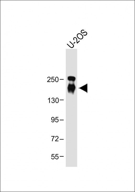 CD163L1