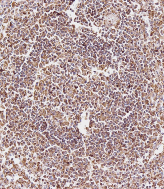 Rabbit Polyclonal Antibody to CD163L1