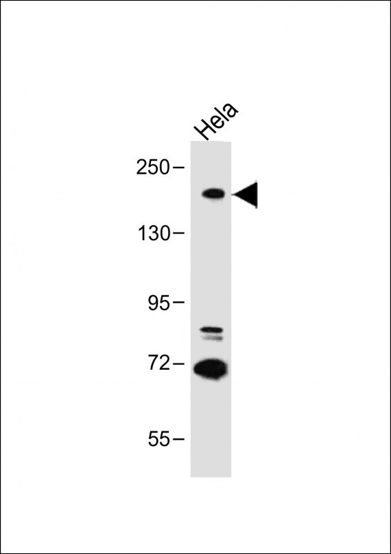 DIP2A