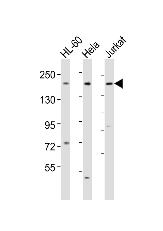 Rabbit Polyclonal Antibody to DIP2A