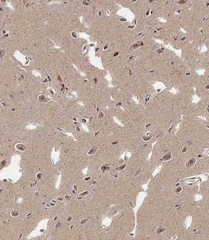 Rabbit Polyclonal Antibody to ADAMTS17