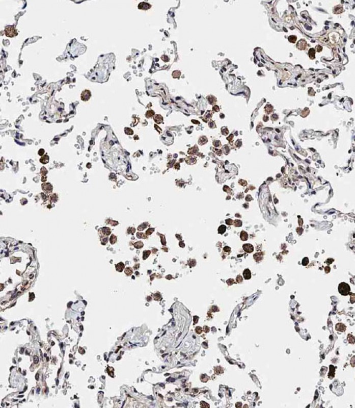 Rabbit Polyclonal Antibody to ADAMTS17