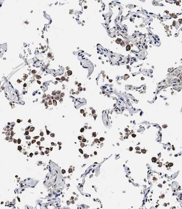 Rabbit Polyclonal Antibody to ADAMTS17