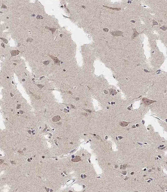 Rabbit Polyclonal Antibody to ADAMTS17