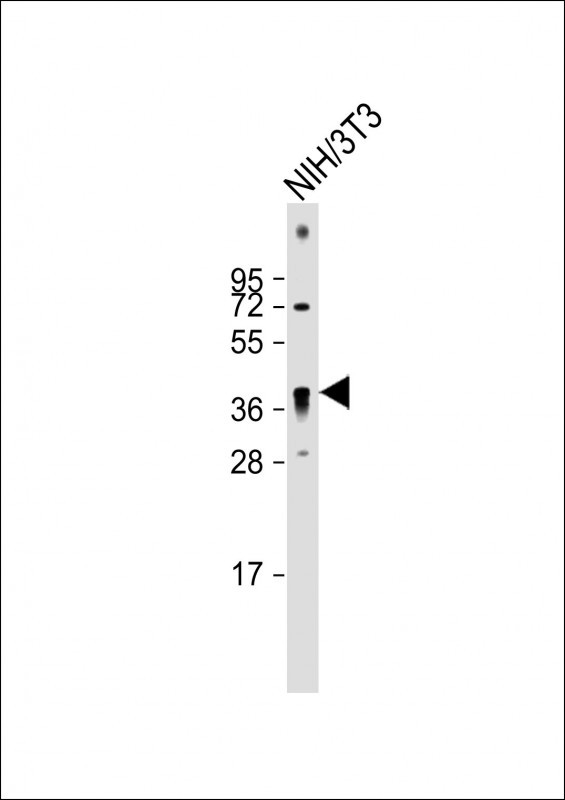 QKI (N-term)