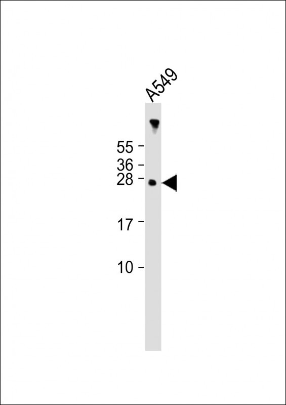 AANAT (N-term)