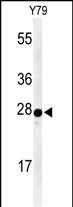 Rabbit Polyclonal Antibody to AANAT (N-term)