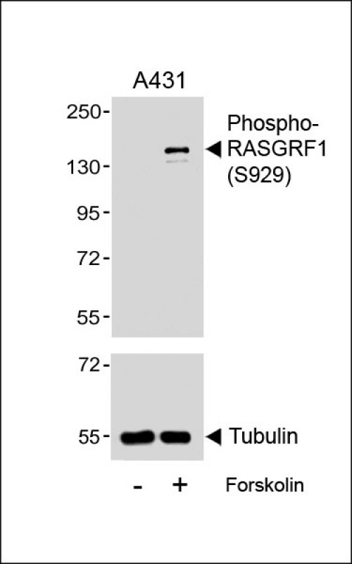 Phospho-RASGRF1(S929)