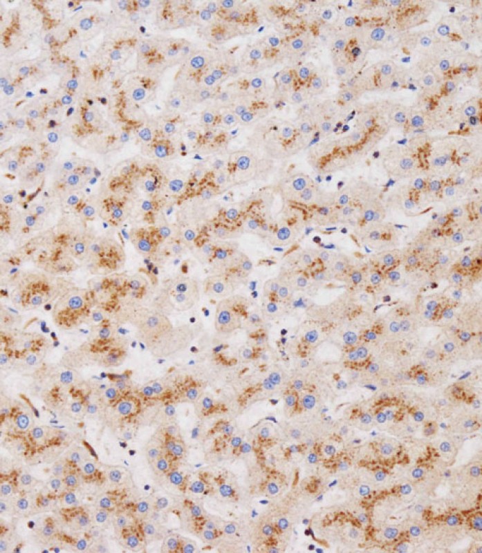 Rabbit Polyclonal Antibody to CLEC4F