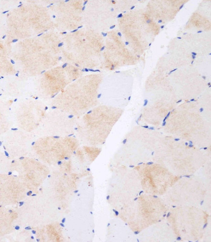 Rabbit Polyclonal Antibody to CLEC4F