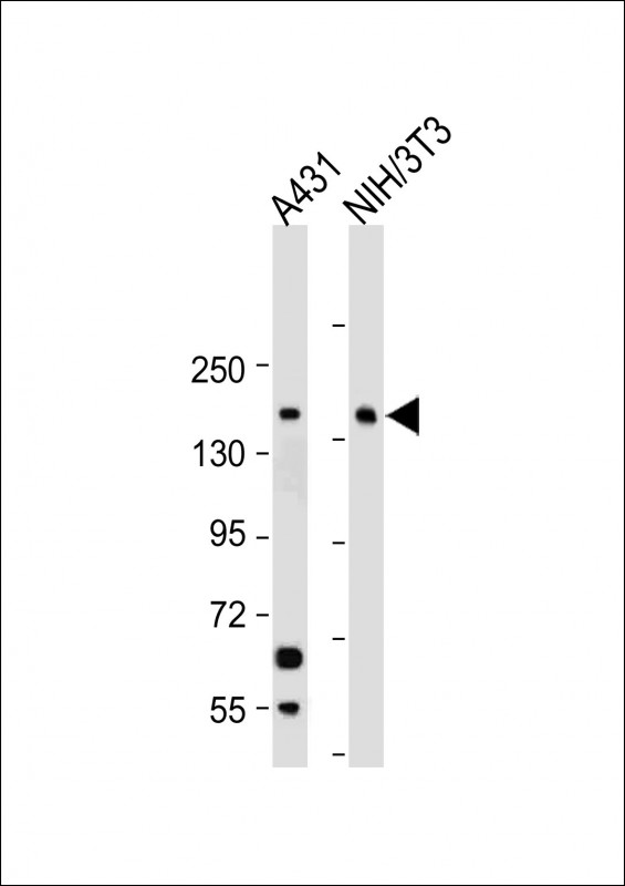 RECQL4(C-term)