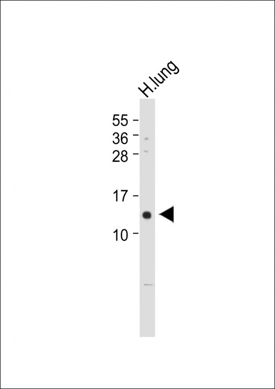 VKORC1 (N-term)