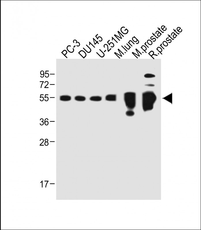 Rabbit Polyclonal Antibody to ACPP