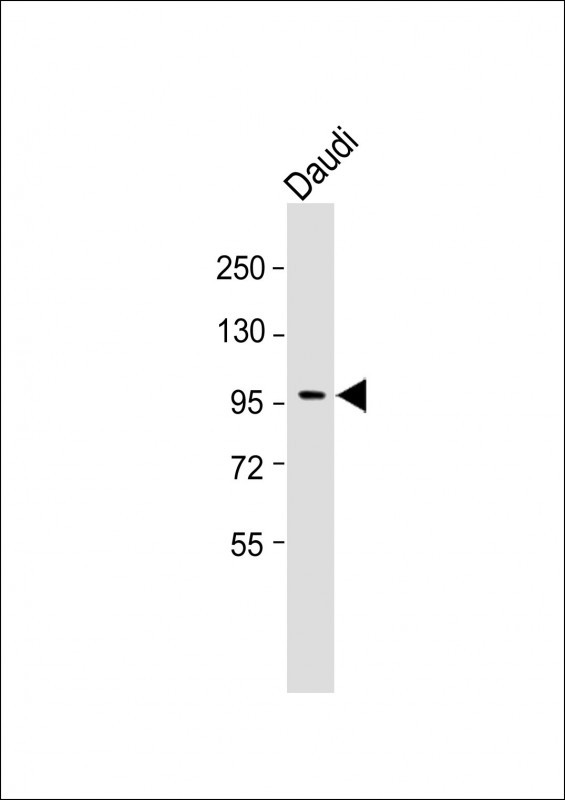 INPP5B