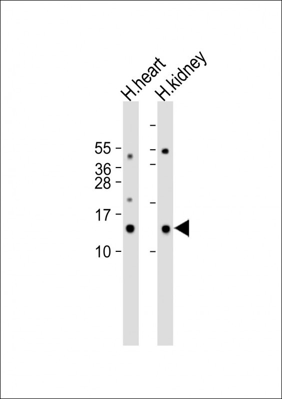 ND3 (N-term)