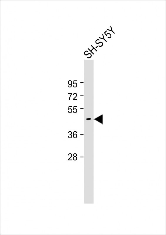 TSPYL5