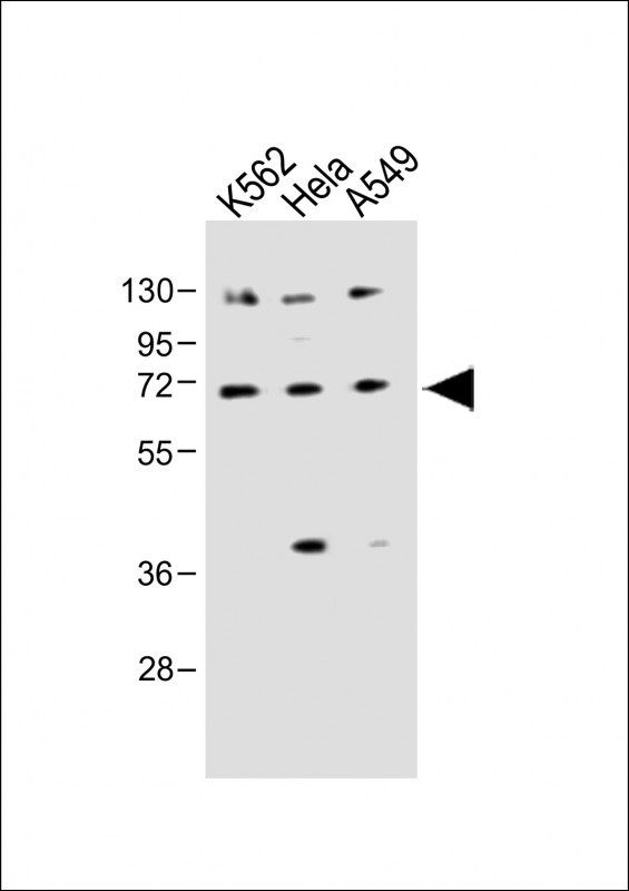 SLC22A4