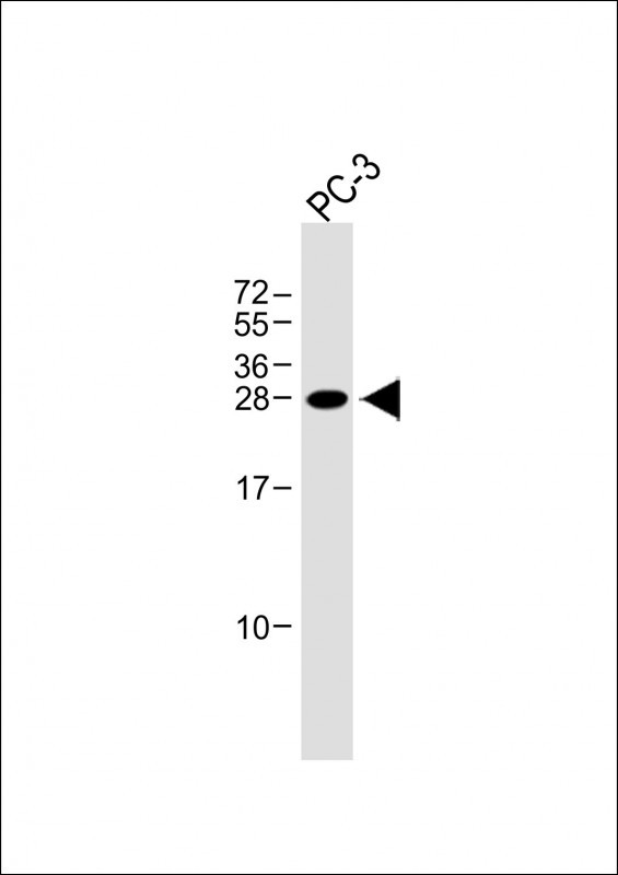 NDFIP1