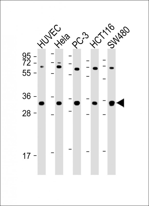 TNFRSF6B (N-term)