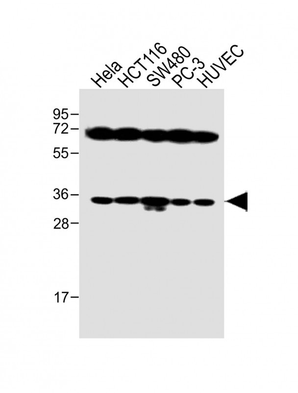 Rabbit Polyclonal Antibody to TNFRSF6B (N-term)