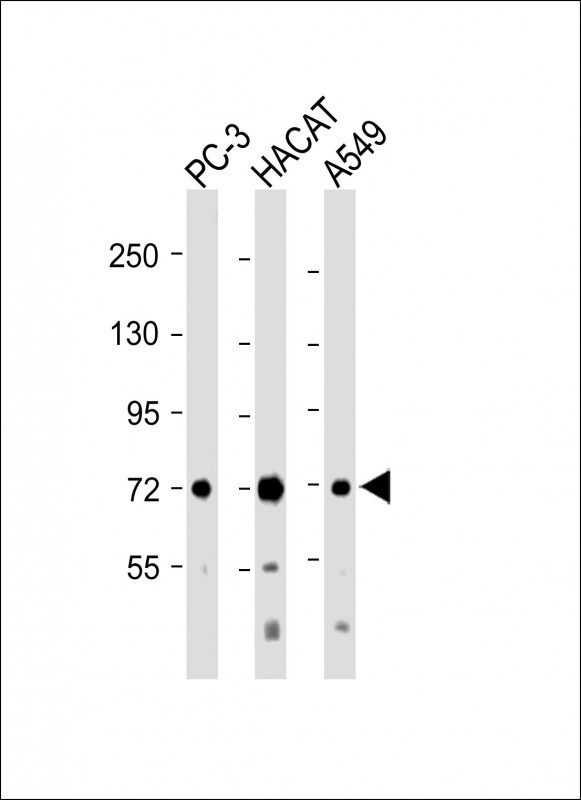 LRP10 (N-term)
