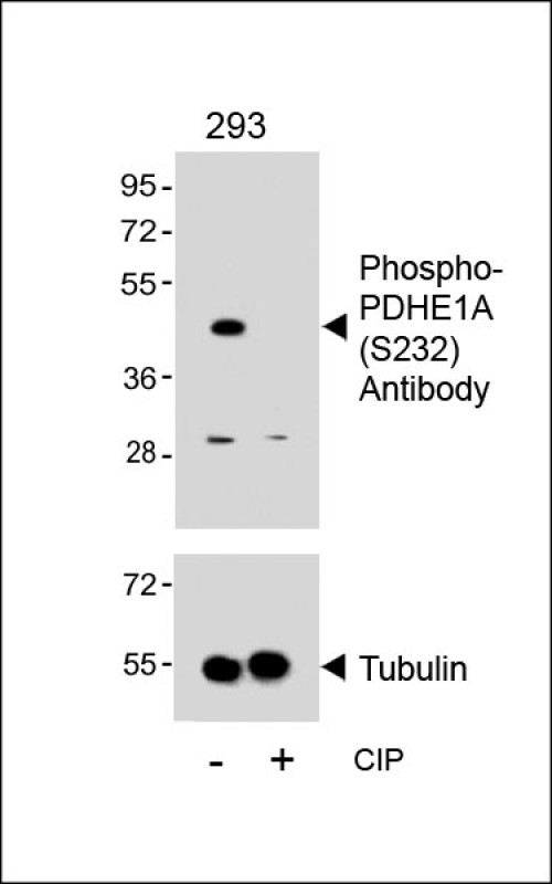 Rabbit Polyclonal Antibody to Phospho-PDHE1A(S232)