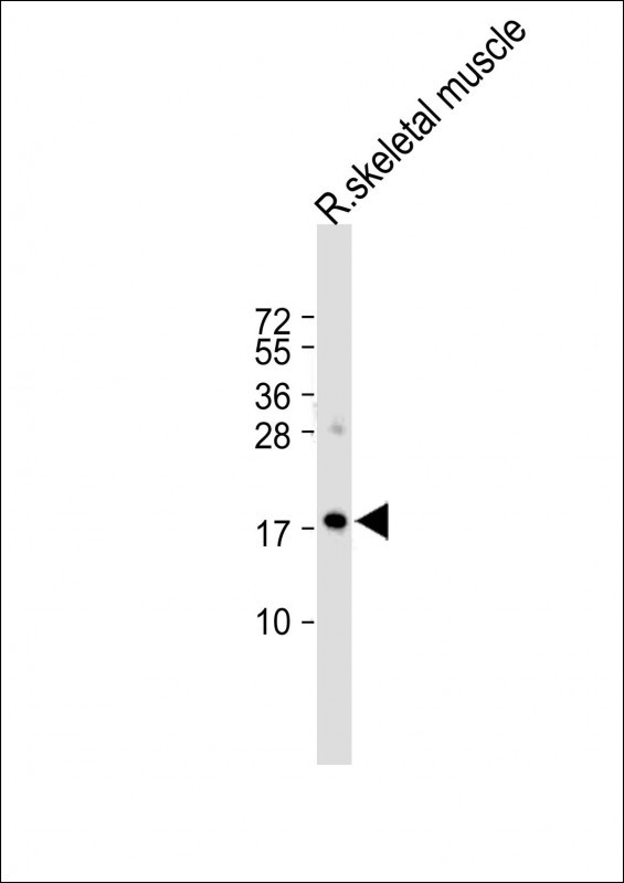 ORMDL3