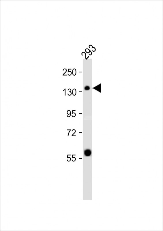 SET1B