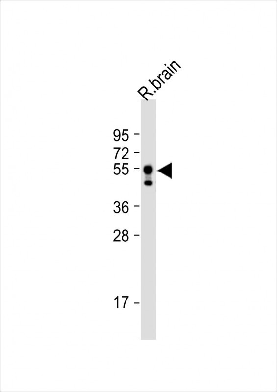 USP27X (N-term)