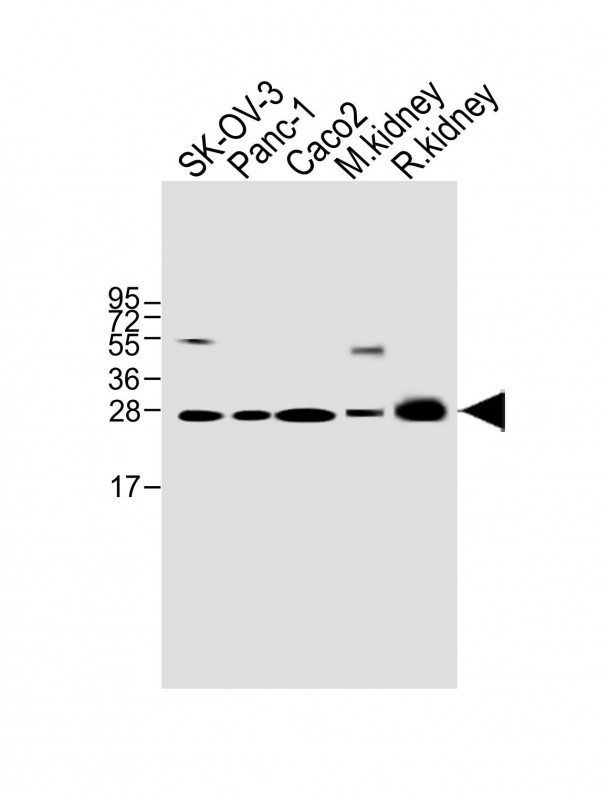 TMEM97 (N-term)