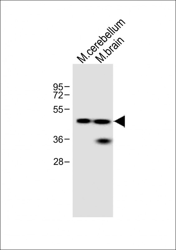 Evx2 (N-term)