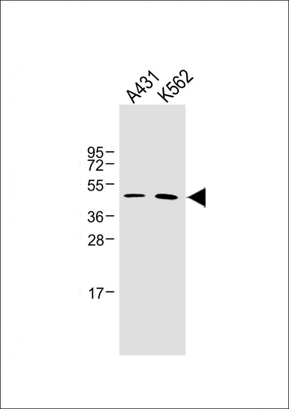 ZDHHC6