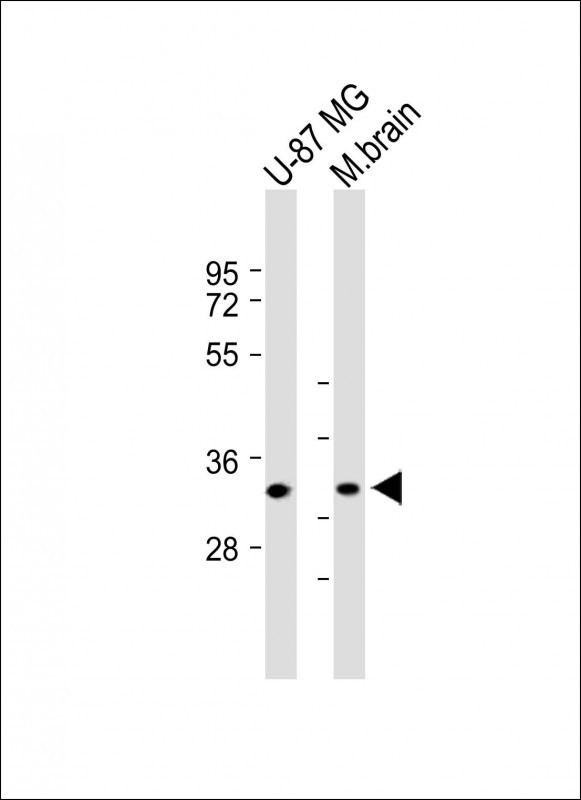 TMEM158