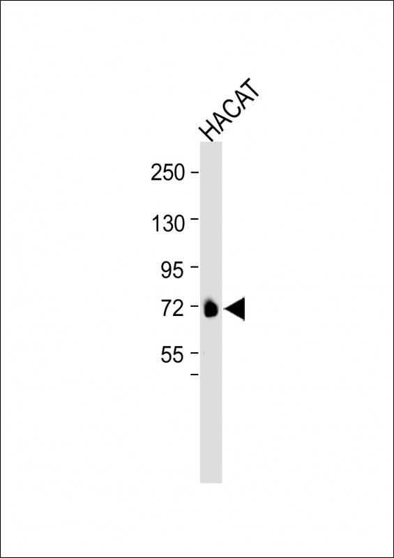 ESRP1  (N-term)