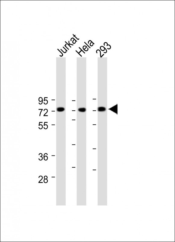 PRDM6 (N-term)