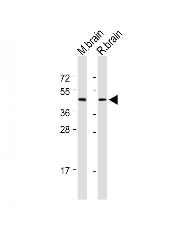 MCHR1