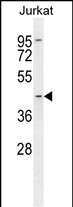 Rabbit Polyclonal Antibody to LOC441476