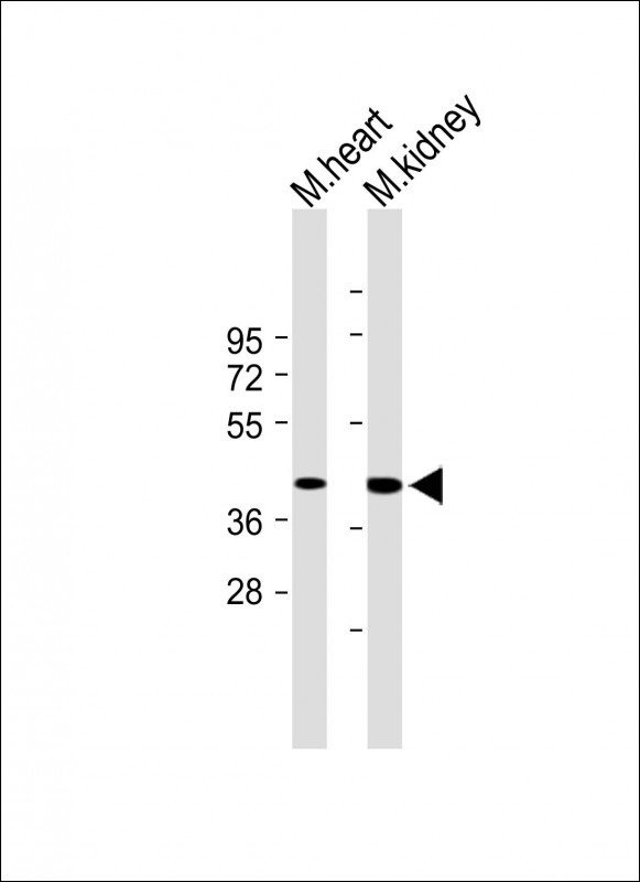 TMEM120A (N-term)