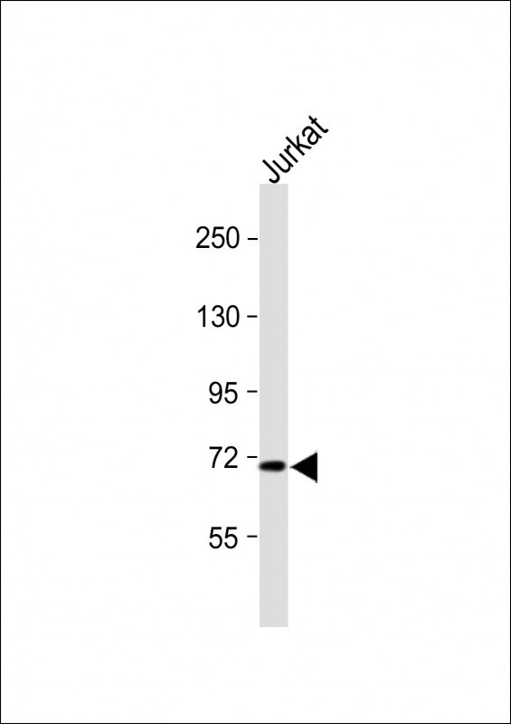 SLC9A6