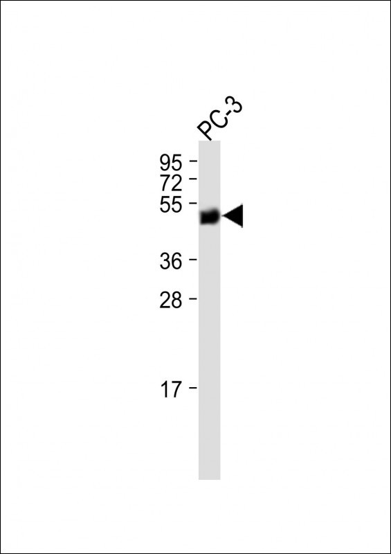 KRT37