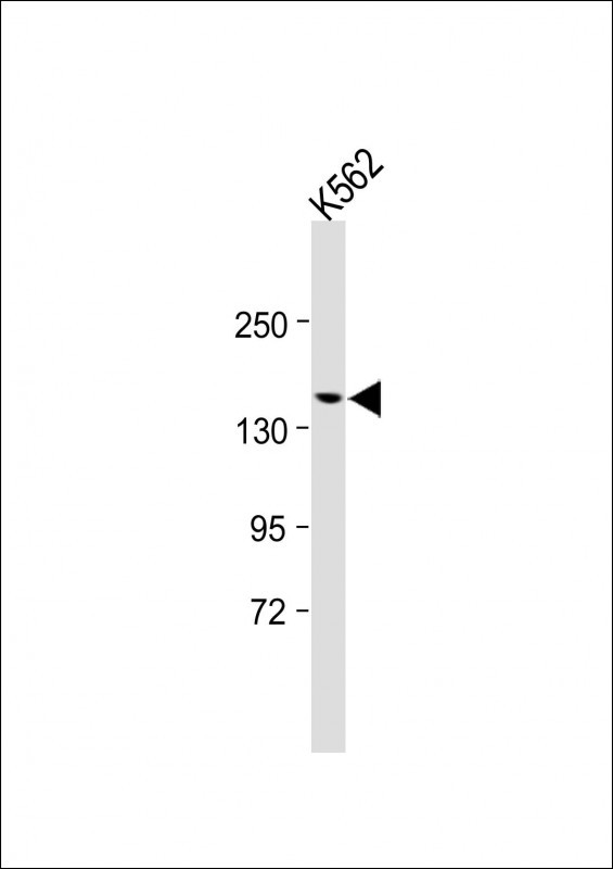 UBN2 (N-term)