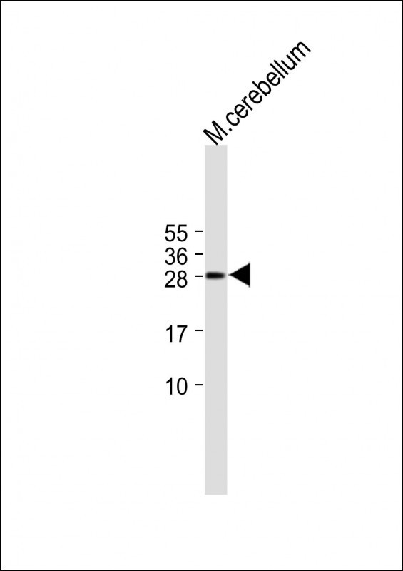 RIMS4 (N-term)
