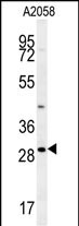 Rabbit Polyclonal Antibody to RIMS4 (N-term)