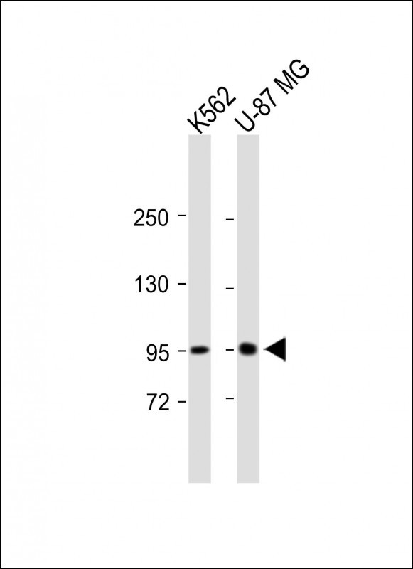 Rabbit Polyclonal Antibody to ENAM