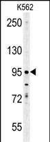 Rabbit Polyclonal Antibody to ENAM